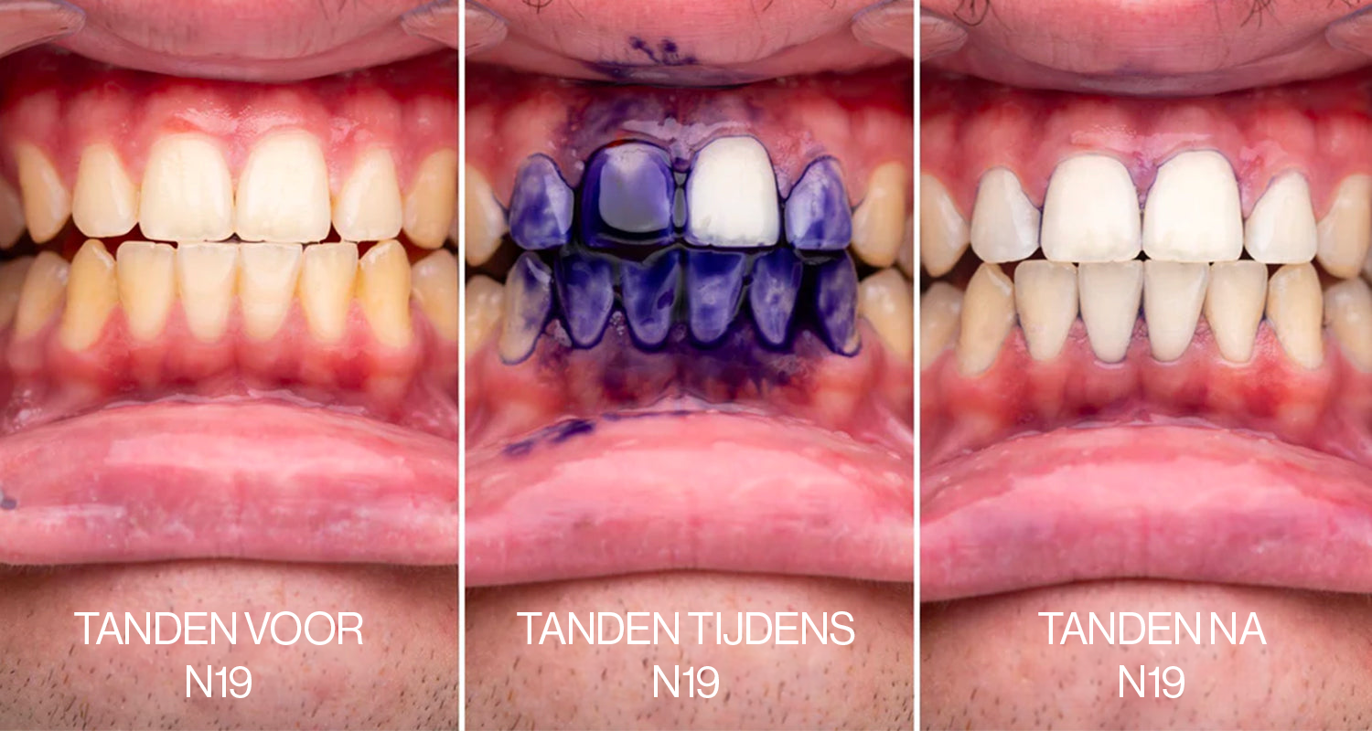 Fruit Toothpaste - Whitening Bundle